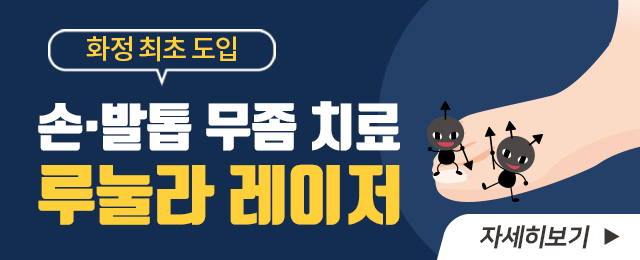 루눌라레이저